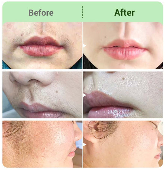💛Hair Removal Cream Kit