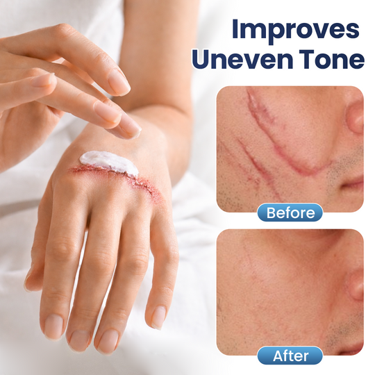 𝑶𝒇𝒇𝒊𝒄𝒊𝒂𝒍 𝑺𝒕𝒐𝒓𝒆 | LBMLBM® Texture Repair Gel — Say Goodbye to Stubborn Scars & Uneven Texture in 4 Weeks