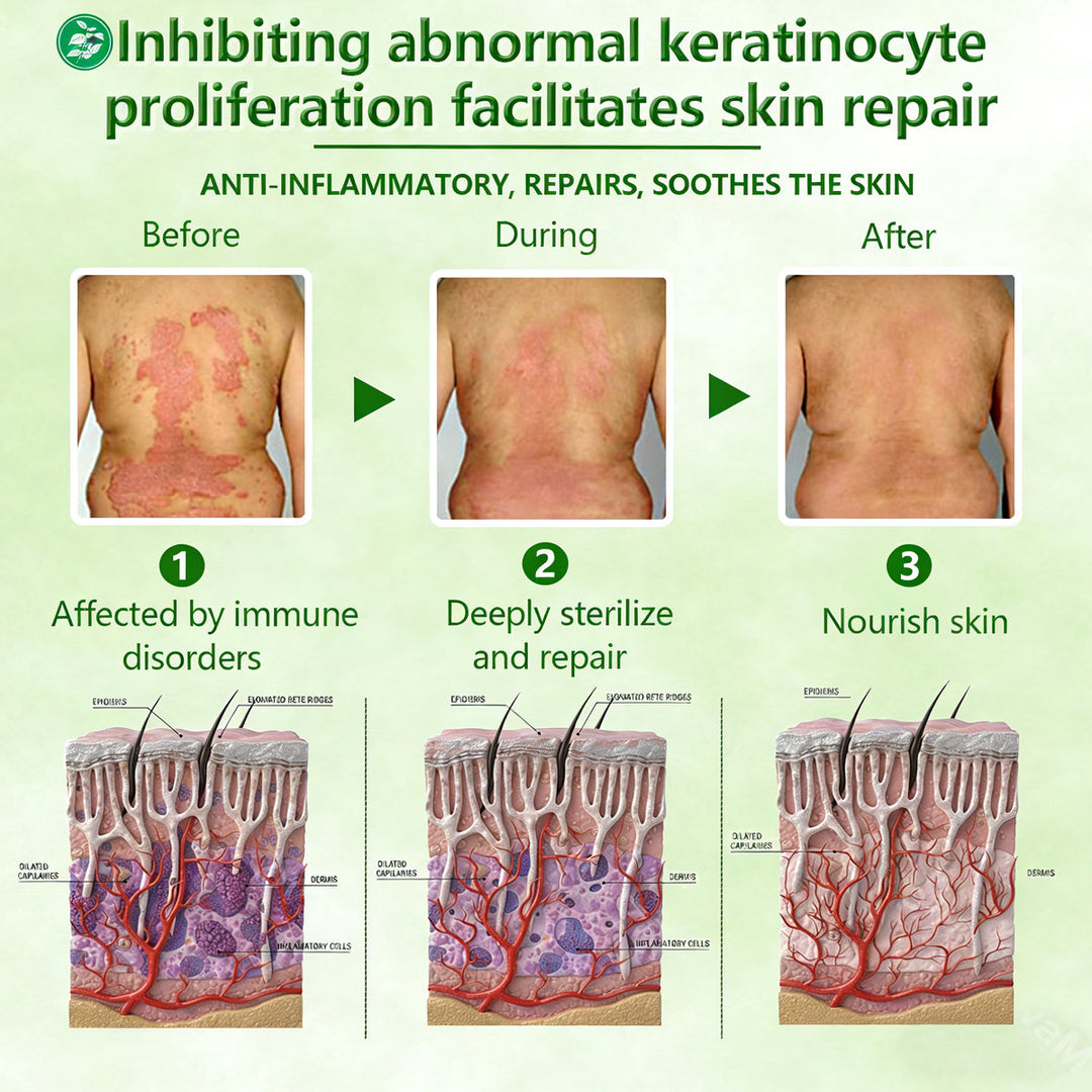 🔥Limited-Time Offer Herbal Miracle Cream for Stubborn Skin Issues
