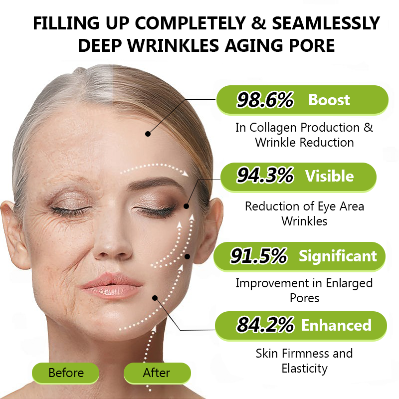 𝑶𝒇𝒇𝒊𝒄𝒊𝒂𝒍 𝑺𝒕𝒐𝒓𝒆👍| Recăpătează-ți tinerețea pielii 💫STDEI® BOTOX & Cremă antirid VITA A RETINOL SHOT