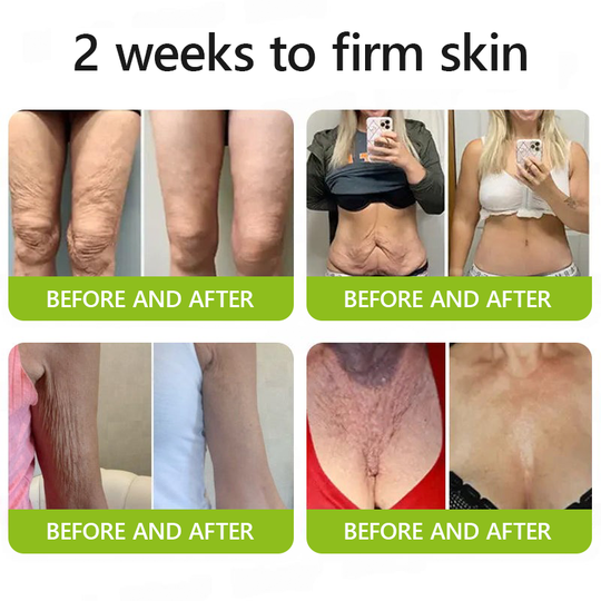 𝑶𝒇𝒇𝒊𝒄𝒊𝒂𝒍 𝑺𝒕𝒐𝒓𝒆👍| Recăpătează-ți tinerețea pielii 💫STDEI® BOTOX & Cremă antirid VITA A RETINOL SHOT