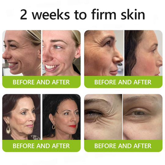 𝑶𝒇𝒇𝒊𝒄𝒊𝒂𝒍 𝑺𝒕𝒐𝒓𝒆👍| Recăpătează-ți tinerețea pielii 💫STDEI® BOTOX & Cremă antirid VITA A RETINOL SHOT