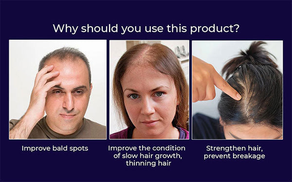 HZA™ Spray natural para el crecimiento del cabello