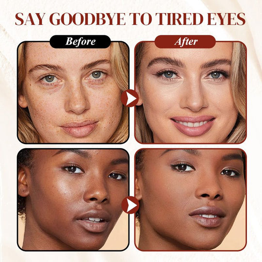 🏆 Last Day💜Buy 1 Get 1 Free✨ Colored Clay Undereye Corrector（Free Concealer Brush）
