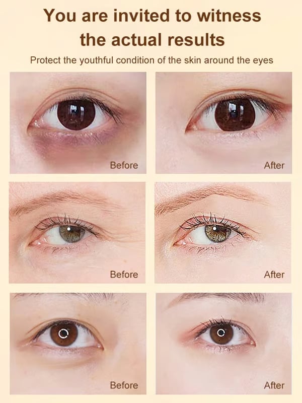 🔥VIIMEINEN PÄIVÄ 49% POIS✨ Luteiini silmänympärysihoöljy✨