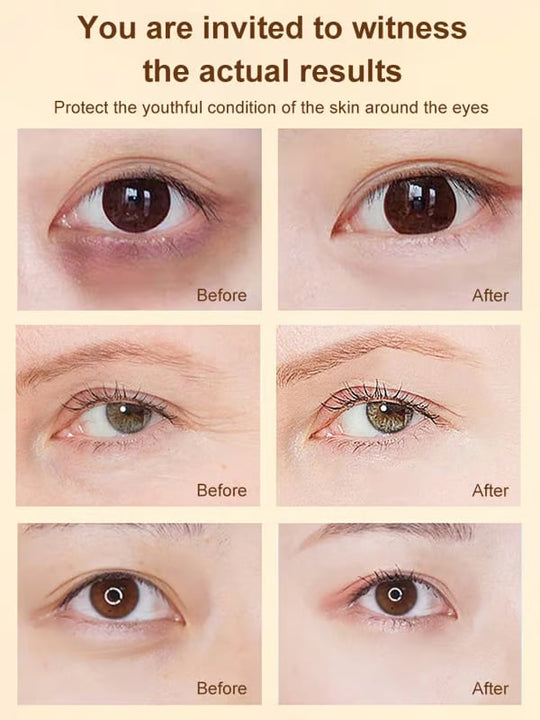 🔥VIIMEINEN PÄIVÄ 49% POIS✨ Luteiini silmänympärysihoöljy✨