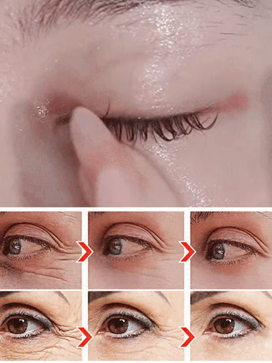 🔥VIIMEINEN PÄIVÄ 49% POIS✨ Luteiini silmänympärysihoöljy✨