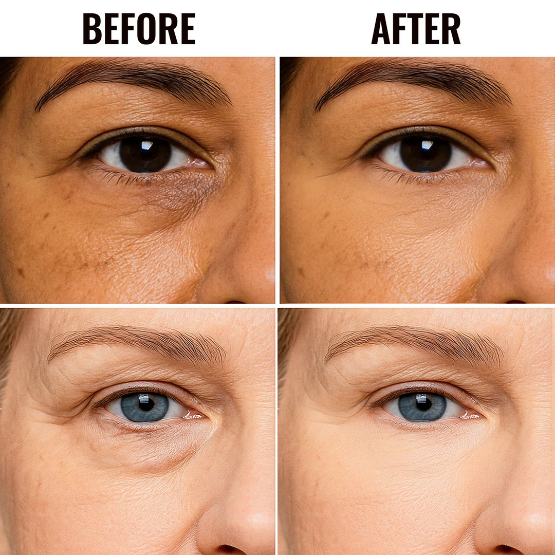 ✨ DERNIER JOUR DE PROMOTION ! 1 ACHETÉ = 1 OFFERT✨Correcteur illuminateur pour le contour des yeux & Éclaircir les cernes