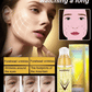 🔥Last Day Buy 1 get 1 free 🔥Ecdoin anti aging essence