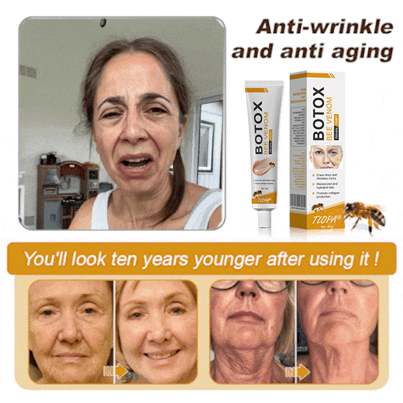 🧑‍⚕️TLOPA® Botox Bee Venom Wrinkle Removal Cream🔥