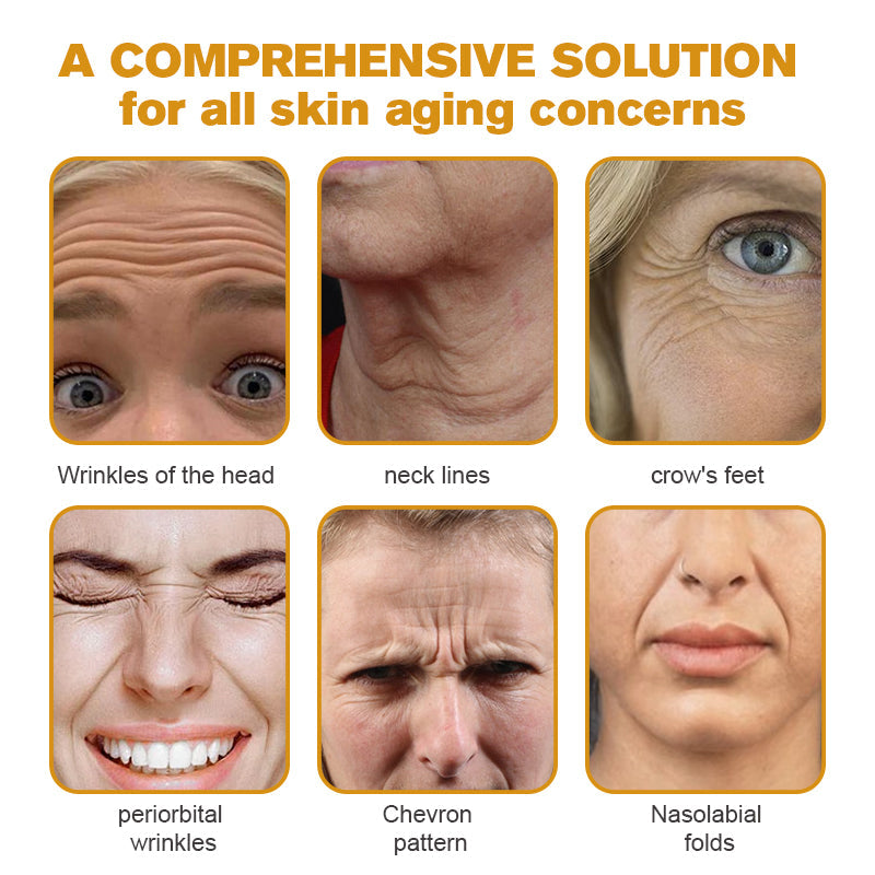 🧑‍⚕️TLOPA® Botox Bee Venom Wrinkle Removal Cream🔥