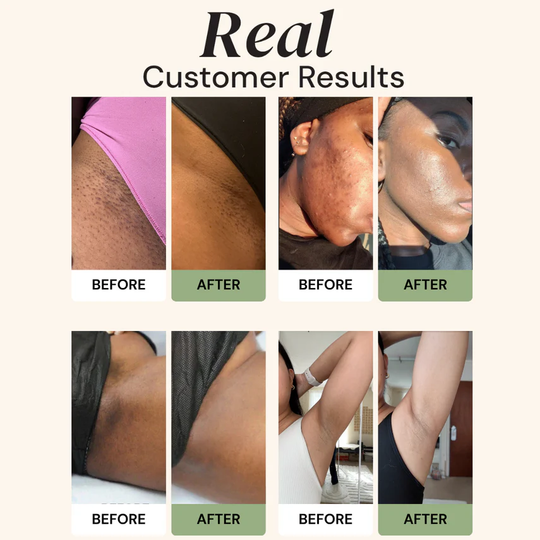 CuraGlow Anti-Spots & Hyperpigmentation Soap