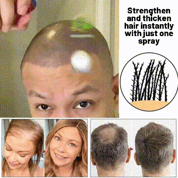 HZA™ Spray natural para el crecimiento del cabello