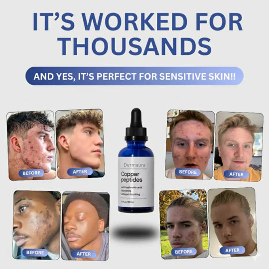Επισκευή Dermaura GHK-Cu