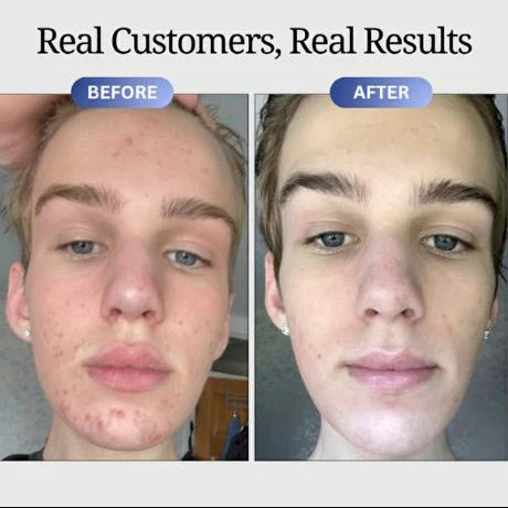 Επισκευή Dermaura GHK-Cu
