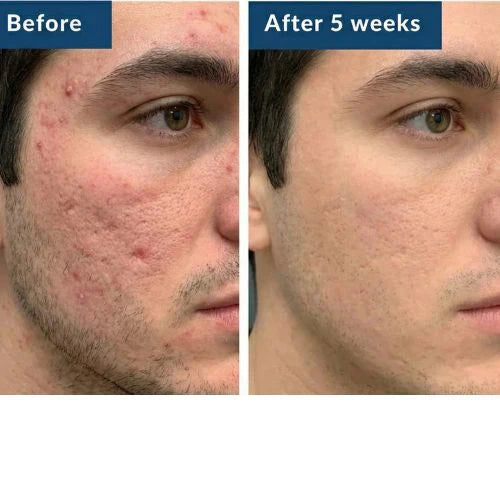 Επισκευή Dermaura GHK-Cu