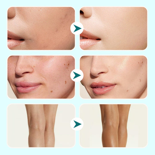 💜Last Day-Buy 1 Get 1 Free!💜All-in-One Moisturizing Concealer Waterproof Cream