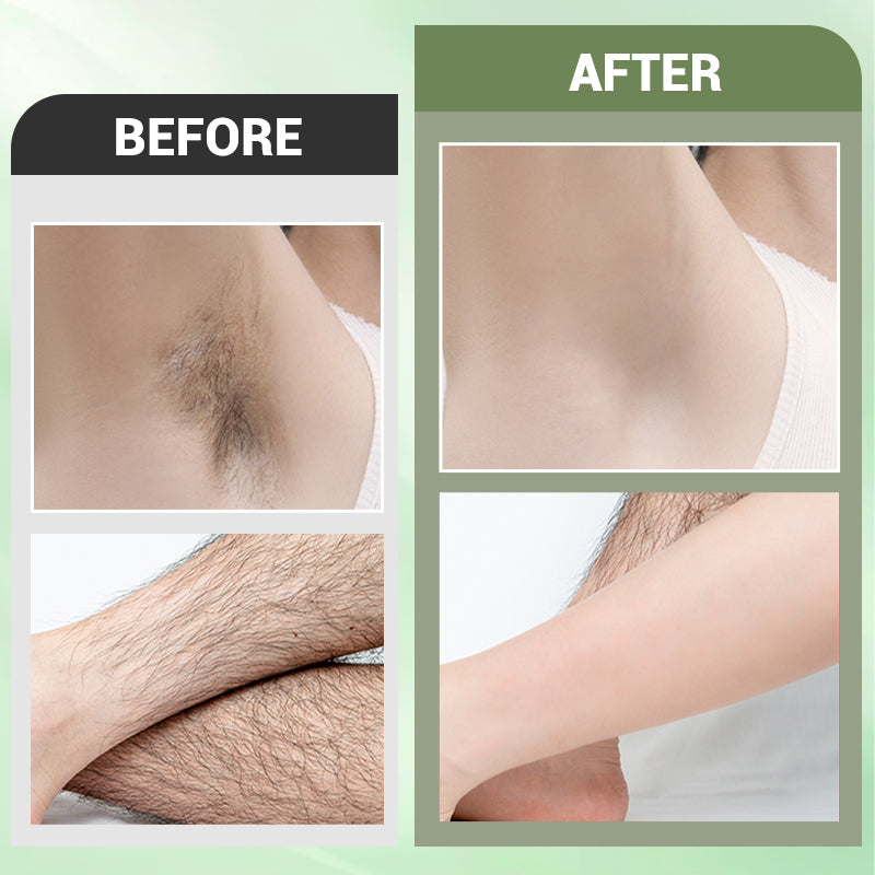 ⏳Piiratud aja jooksul 50% allahindlust💥3-osaline karvaeemalduskreemi komplekt kogu kehale