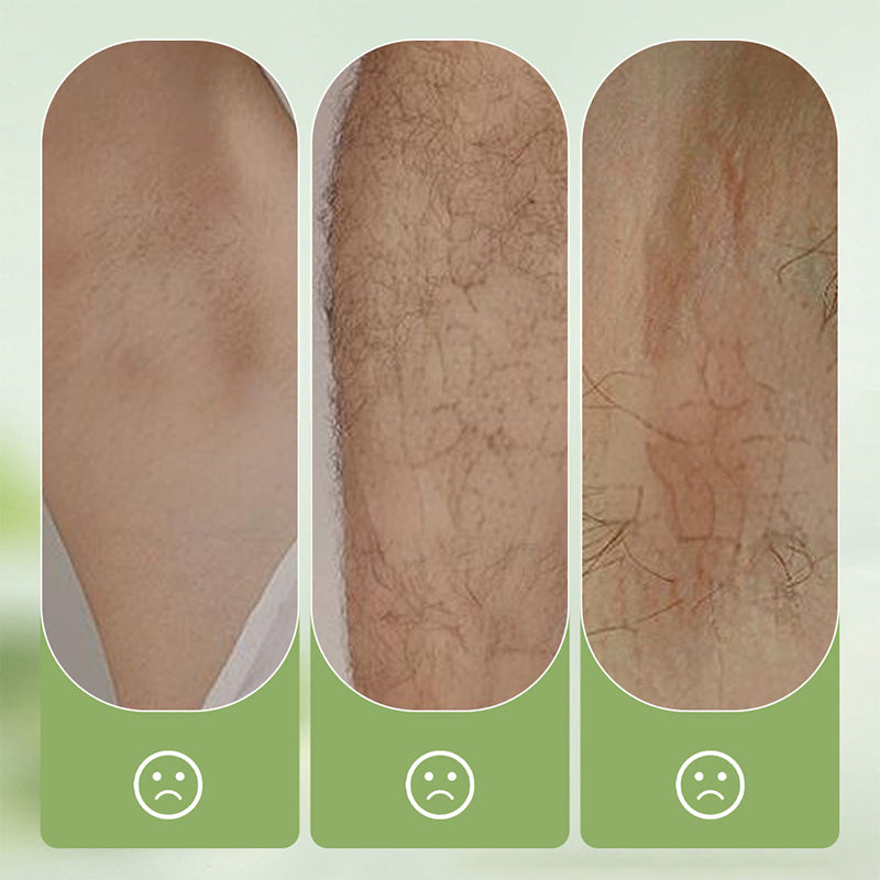 🔥🔥Gentle and Non-Irritating Hair Removal Cream